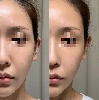 男女同額完全個室脱毛 LEPIA内田のエステ・リラクイメージ