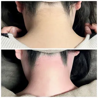 B&H所属・頭痛•肩こり専門/ 眉サロンB&H心斎橋のエステ・リラクイメージ