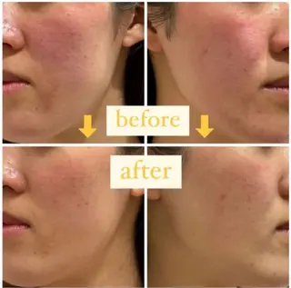 SOIS上中居店所属・佐々木 麻裕のエステ・リラクイメージ