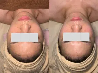 a room salonのエステ・リラクイメージ