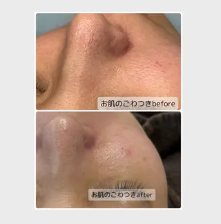 Beauty Salon   Cherir～シェリール～所属・SUZUKI ～Cherir～のエステ・リラクイメージ