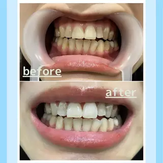 メンズ お手軽ホワイトニングsalon mina所属・武元 奈津美のその他イメージ