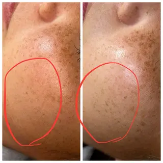 伊藤 稚菜のエステ・リラクイメージ