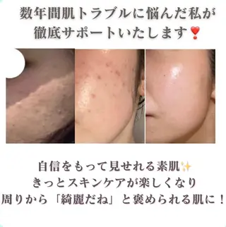 aisea（アイシー）所属・アイシー 〜大人の毛穴ツヤ肌〜のエステ・リラクイメージ