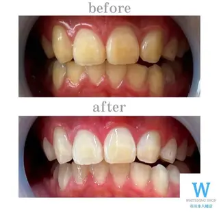 ホワイトニング ショップ本八幡店のエステ・リラクイメージ