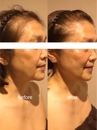 マスカットサロン所属・マスカットサロン 小野寺のエステ・リラクイメージ