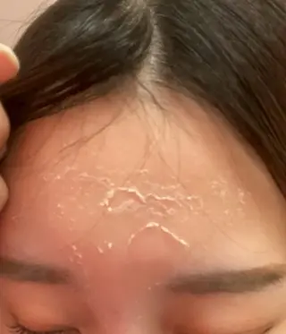 美肌ケアサロンhalu【ハーブピーリング/脱毛】所属・美肌ケアサロン halu（ハル）のその他イメージ