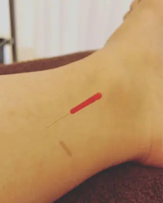 妙蓮寺ゆう鍼灸院所属・太田祐志 /中医美容鍼のエステ・リラクイメージ