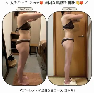 biloop所属・《本気痩せ×疲労改善 》  BILOOPのエステ・リラクイメージ