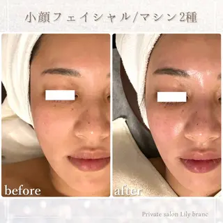 Lily branc 痩身/小顔/肌質改善のエステ・リラクイメージ