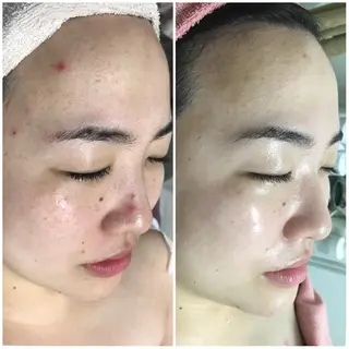 高速脱毛エステ リアンのエステ・リラクイメージ