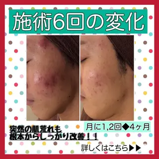 ミディアム カラー パーマ ヘアアレンジ メンズ キッズ ネイル マツエク・マツパ ニキビ・肌質改善専門 ♡人生が変わるサロンのエステ・リラクイメージ