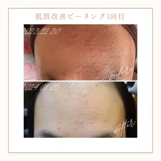 小顔×肌質改善サロン soin〔ソワン〕のエステ・リラクイメージ