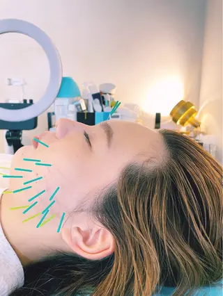 小顔美容鍼専門サロン 渋谷YZのその他イメージ