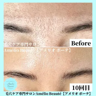 毛穴ケア専門サロン Amélio Beauté所属・毛穴ケア専門サロン アメリオボーテのその他イメージ