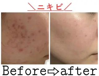 ミディアム カラー パーマ ヘアアレンジ メンズ キッズ ネイル マツエク・マツパ ニキビ&跡改善サロン オーナー光木のエステ・リラクイメージ