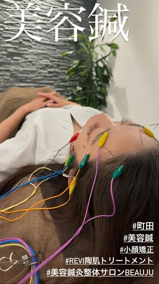 美容鍼灸整体サロンBeauJu所属・小顔矯/美容鍼/鍼灸 BeauJuのその他イメージ