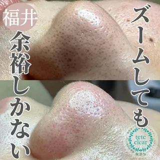 毛穴肌質ケアサロン Yourmeユアミーのエステ・リラクイメージ