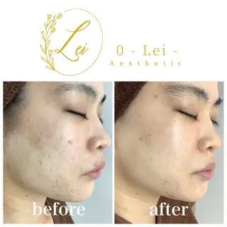 0-Lei-aesthetic所属・レイエステティック スタッフのエステ・リラクイメージ