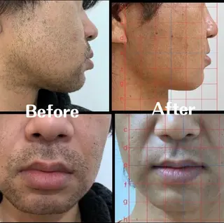 メンズ トータルビューティー サロンCherie2のエステ・リラクイメージ