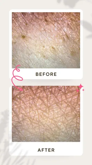 aesthetic éclatのエステ・リラクイメージ