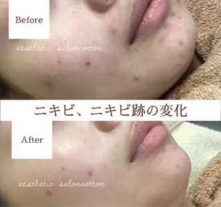 都度払い 肌質改善専門サロンのエステ・リラクイメージ