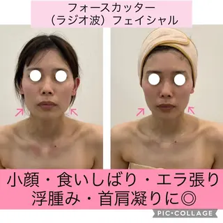 ブライダル痩身×脱毛 尼崎駅前サロンのエステ・リラクイメージ