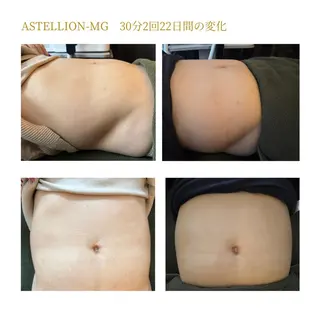 Sylphya (シルフィア)のエステ・リラクイメージ