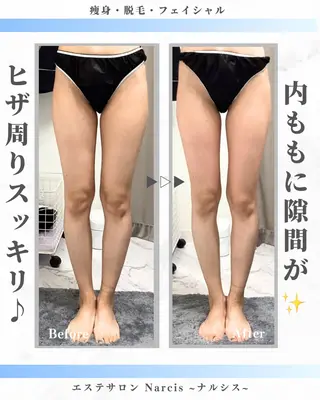 エステサロンNarcis〜ナルシス〜所属・脱毛＆痩身エステ Narcisのエステ・リラクイメージ