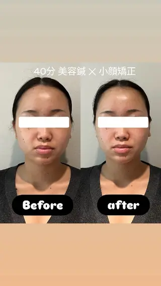 美容鍼灸サロンAria所属・美容鍼サロンAria 杉元みつるのエステ・リラクイメージ