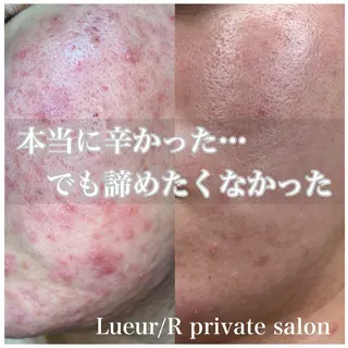 大久保 里奈のエステ・リラクイメージ