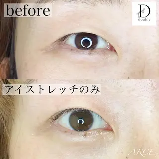 マツエク・マツパ 美容室 ARCE所属・セラピスト MIKIのエステ・リラクイメージ