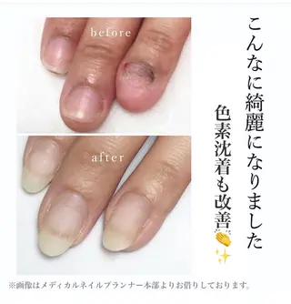 ネイル nailsalon VENUSのネイルデザイン