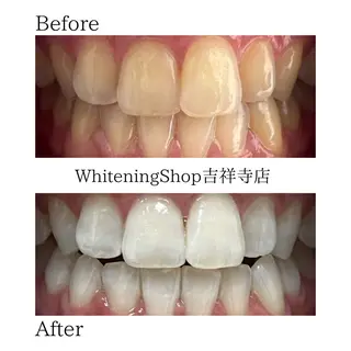 ホワイトニング ショップ吉祥寺店のエステ・リラクイメージ