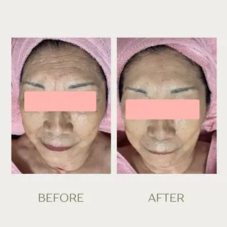 ピーリングケア 🤍moekoのエステ・リラクイメージ