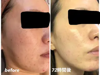 ビューティサロン aiwaのエステ・リラクイメージ