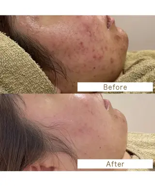 エステサロン .BXのエステ・リラクイメージ