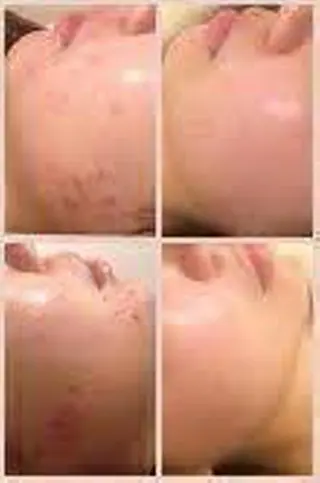 痩身リンパダイエット 隠れ家サロンチャームのエステ・リラクイメージ