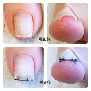 ネイル MII*NAIL／ 美フォルムsalonのネイルデザイン