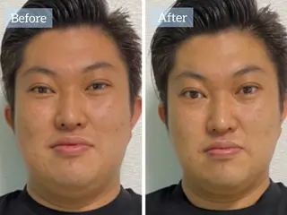 肌質改善専門店 Re.terna田辺のエステ・リラクイメージ