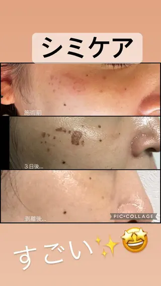 ANGEL NAIL所属・RE:BORN 大阪四條畷市のエステ・リラクイメージ