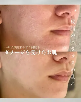 カムイ所属・カムイ 山﨑のエステ・リラクイメージ