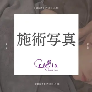 小顔＆まつ毛サロン AKANE❤️のエステ・リラクイメージ