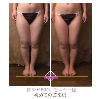 代表 MOMOのエステ・リラクイメージ