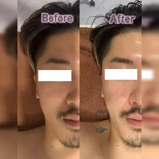 LAGRECE 大阪梅田店のエステ・リラクイメージ