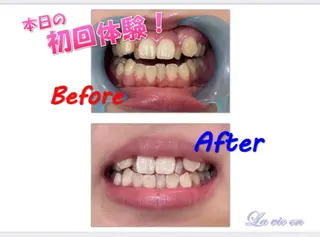 セルフホワイトニングサロン　ラヴィアン所属・ホワイトニングサロン La vie enのその他イメージ