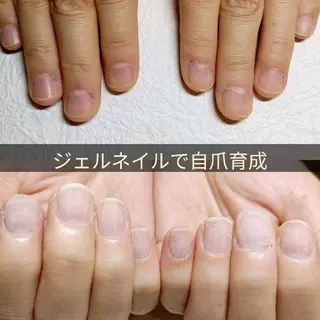 ネイル 深爪矯正/爪育成ケア manie nailのネイルデザイン