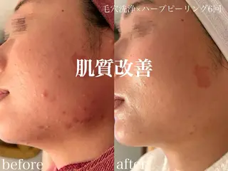 肌管理サロン neoriiのその他イメージ