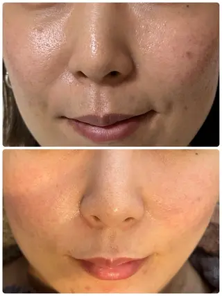 Sena Dewi所属・Sena Dewi SAE🌼のエステ・リラクイメージ