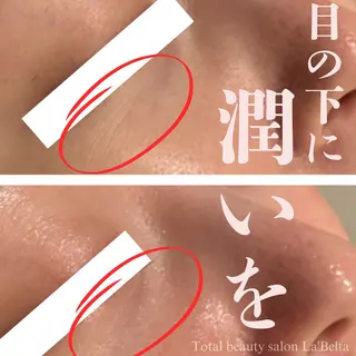 ラベルタ 上野のエステ・リラクイメージ